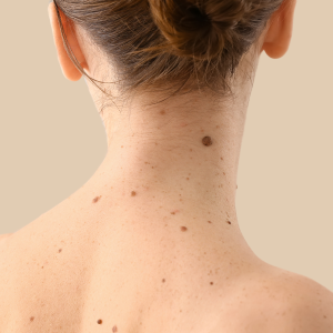 Tienda-online-electrocauterio-clinicas-dh