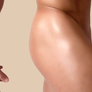 clinicasdh-laser-hombre-gluteos