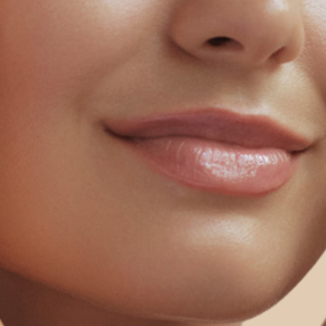 depilacion-laser-labio-superior-clinicasdh