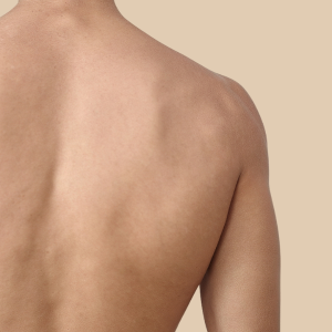 depilacion-laser-espalda-hombre-clinicadh