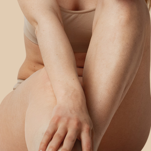 medias-piernas-mujer-depilacion-medica-laser-clinicas-dh