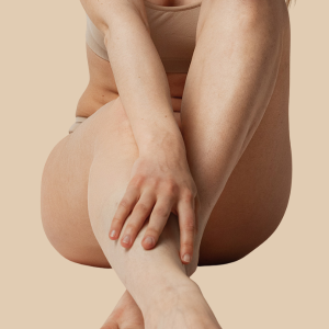 medias-piernas-mujer-depilacion-medica-laser-clinicas-dh
