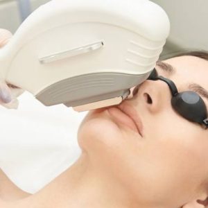 rejuvenecimiento-facial-ipl-clinicasdh