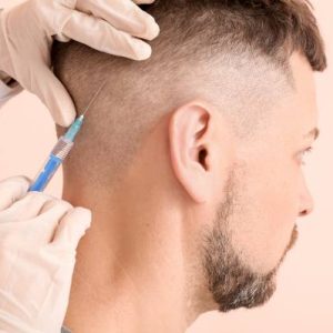 tratamiento-para-la-alopecia-clinicasdh